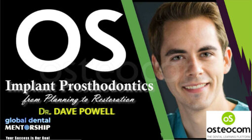 Osteocom Implant Prosthodontics, from Planning to Restoration - David Powell
