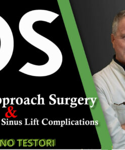 Osteocom Crestal Approach Surgery and Management Of Sinus Lift Complications - Tiziano Testori An up-to-date, comprehensive guide to sinus lift surgery using the crestal approach