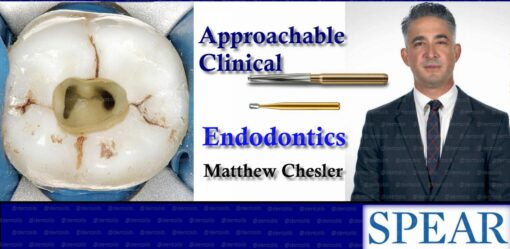 Spear Approachable Clinical Endodontics - Matthew Chesler