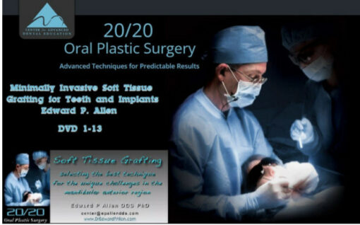 Minimally Invasive Soft Tissue Grafting for Teeth and Implants