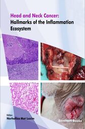 Head and Neck Cancer: Hallmarks of the Inflammation Ecosystem (Original PDF)