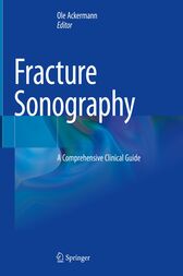 Fracture Sonography (Original PDF)