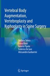 Vertebral Body Augmentation, Vertebroplasty and Kyphoplasty in Spine Surgery (Original PDF)