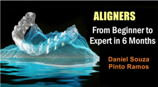 Aligners: From Beginner to Expert in 6 Months