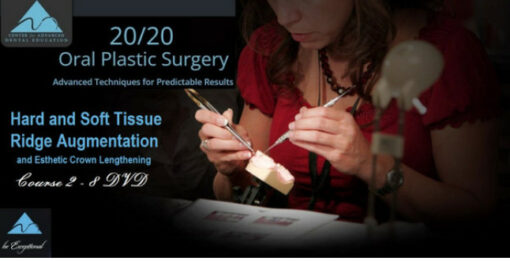 Hard and Soft Tissue Ridge Augmentation and Esthetic Crown Lengthening