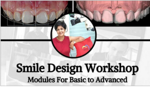 Smile Design Workshop, Modules for Basic to Advanced