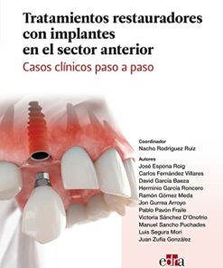 Tratamientos restauradores con implantes en el sector anterior. Casos clínicos paso a paso. 