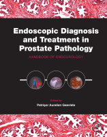 Endoscopic Diagnosis and Treatment in Prostate Pathology Handbook of Endourology 2016 Original pdf