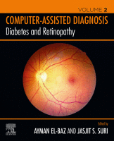 Diabetes and Retinopathy Volume 2: Computer-Assisted Diagnosis A volume in Computer-Assisted Diagnosis 2020 Original pdf