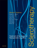 Sclerotherapy Treatment of Varicose and Telangiectatic Leg Veins 2017 Original pdf
