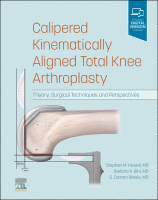 Calipered Kinematically Aligned Total Knee Arthroplasty Theory, Surgical Techniques and Perspectives 2021 Original pdf