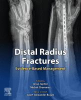 Distal Radius Fractures Evidence-Based Management 2021 Original pdf