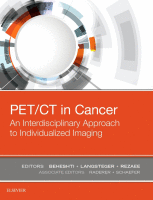 PET/CT in Cancer: An Interdisciplinary Approach to Individualized Imaging 2018 Original pdf
