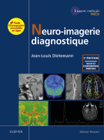 Neuro-Imagerie Diagnostique 2018 Original pdf