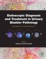 Endoscopic Diagnosis and Treatment in Urinary Bladder Pathology Handbook of Endourology 2016 Original pdf