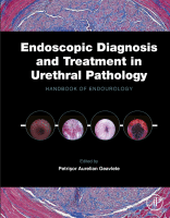 Endoscopic Diagnosis and Treatment in Urethral Pathology Handbook of Endourology 2016 Original pdf