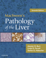 Macsween's Pathology of the Liver 2018 Original pdf