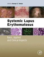 Systemic Lupus Erythematosus Basic, Applied and Clinical Aspects 2016 original pdf