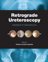 Retrograde Ureteroscopy Handbook of Endourology 2016 Original pdf
