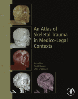 An Atlas of Skeletal Trauma in Medico-Legal Contexts 2018 Original pdf
