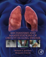 Mechanisms and Manifestations of Obesity in Lung Disease 2019 Original pdf