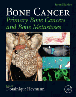 Bone Cancer Primary Bone Cancers and Bone Metastases 2015 Original pdf