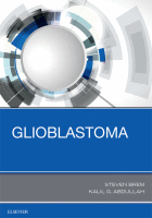 Glioblastoma 2017 original pdf
