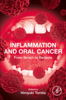 Inflammation and Oral Cancer From Bench to Bedside 2021 original pdf