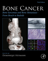 Bone Sarcomas and Bone Metastases - From Bench to Bedside Bone Sarcomas and Bone Metastases - from Bench to Bedside 2021 Original pdf
