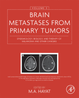 Brain Metastases from Primary Tumors, Volume 3 Epidemiology, Biology, and Therapy of Melanoma and Other Cancers 2016 Original pdf