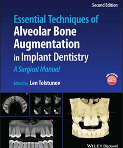 Essential Techniques of Alveolar Bone Augmentation in Implant Dentistry: A Surgical Manual 2nd Edition PDF Original 
