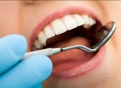DVD Video Treatment of 6 anterior damaged teeth with Composite direct Veneers