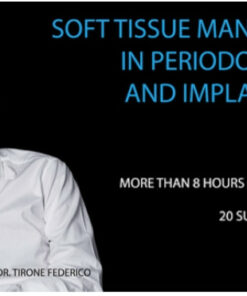 Soft Tissue Management in Periodontology and Implantology