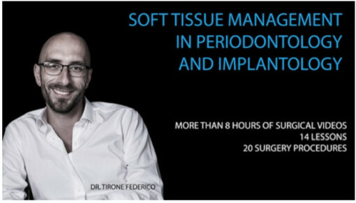 Soft Tissue Management in Periodontology and Implantology