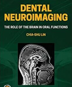Dental Neuroimaging: The Role of the Brain in Oral Functions 1st Edition PDF