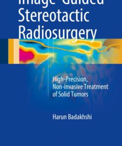 Image-Guided Stereotactic Radiosurgery: High-Precision, Non-invasive Treatment of Solid Tumors (Original PDF from Publisher)