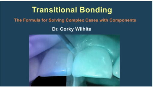 Transitional Bonding – The Formula for Solving Complex Cases with Components