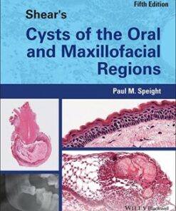 Shear's Cysts of the Oral and Maxillofacial Regions 5th Edition PDF Original 