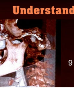 Understanding CBCT (9 Lectures)