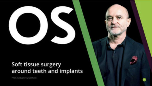 Soft Tissue Surgery Around Teeth and Implants