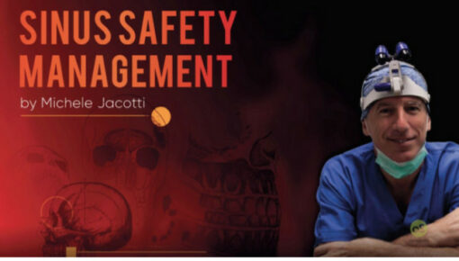 Sinus Safety Management (Sinus Floor Augmentation)