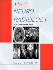 Atlas of Neuroradiology: 200 Common Cases (epub+converted pdf)