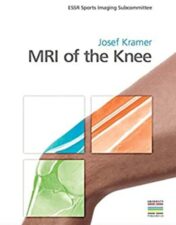 MRI of the Knee, 1st edition 2018 Original PDF