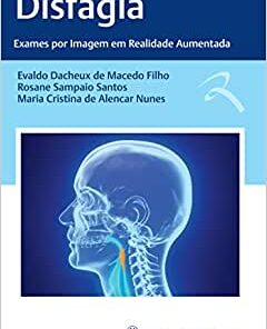 Disfagia: Exames por Imagem em Realidade Aumentada (EPUB)