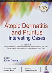 Atopic Dermatitis And Pruritus Interesting Cases original PDF   2020