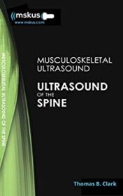 Ultrasound of the Spine, 2nd Edition (Original PDF)