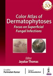 Color Atlas of Dermatophytoses: Focus on Superficial Fungal Infections Original PDF  2021