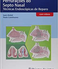 Perfurações do Septo Nasal: Técnicas Endoscópicas de Reparo (Original PDF from Publisher)