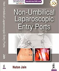 Non-Umbilical Laparoscopic Entry Ports (Original PDF from Publisher)