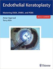 Endothelial Keratoplasty: Mastering DSEK, DMEK, and PDEK (EPUB+pdf)